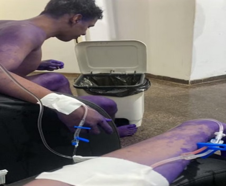 4 Calouros em Rondônia foram hospitalizados devido a trote universitário
